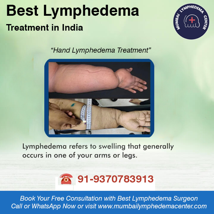 Best lymphedema treatment in Mumbai