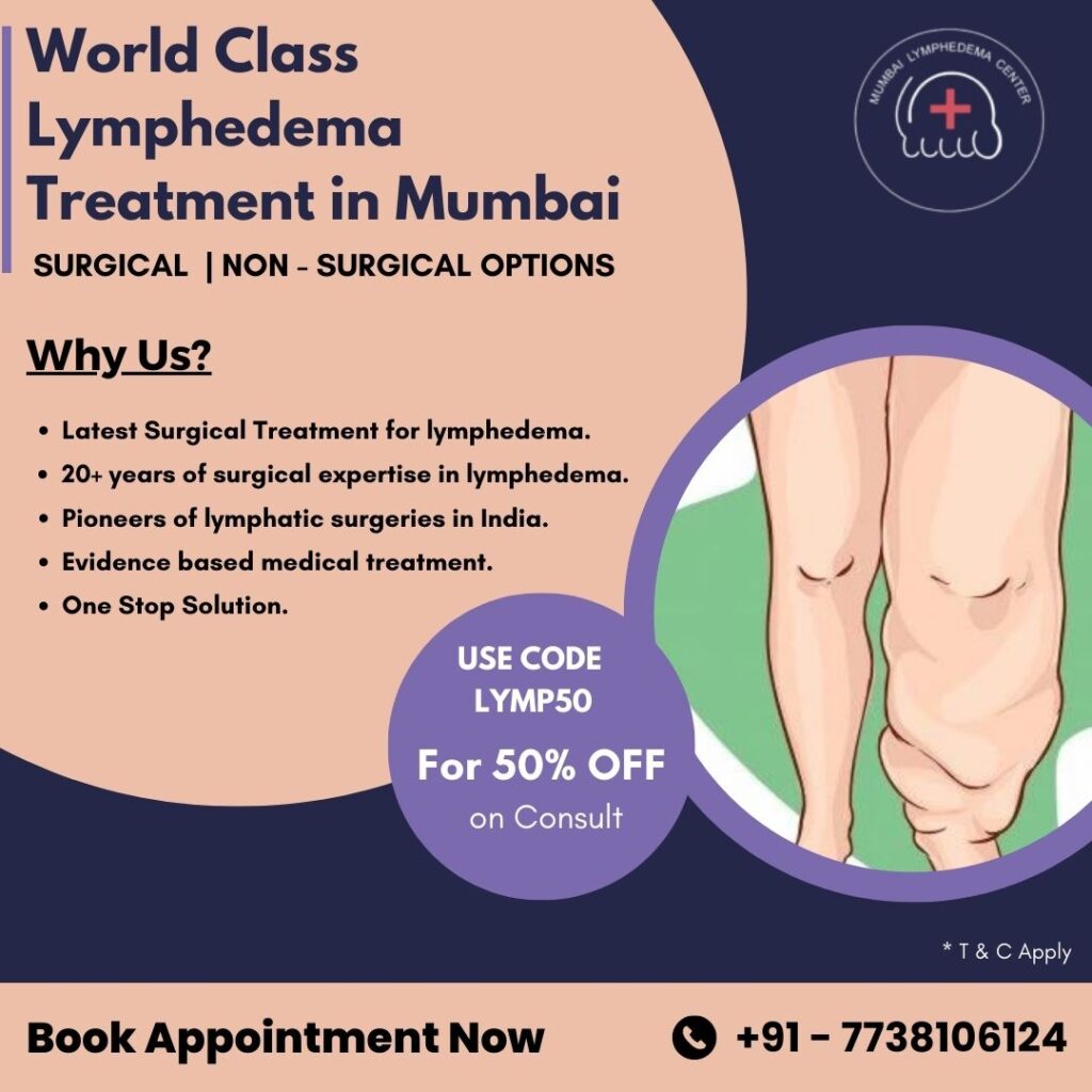 Best Lymphedema Treatment in Mumbai